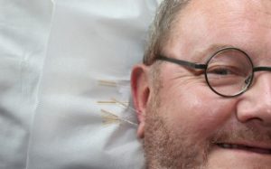 Therapieverfahren 10 Ohrakupunktur